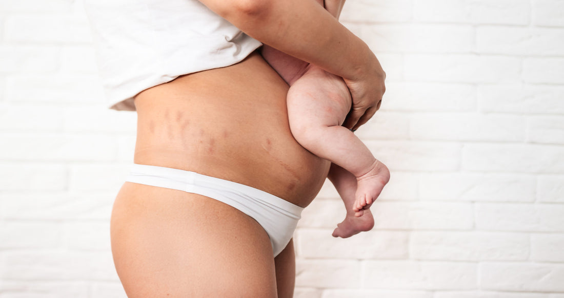 Buy Postpartum Care Postpartum Underwear New Mom Essentials for