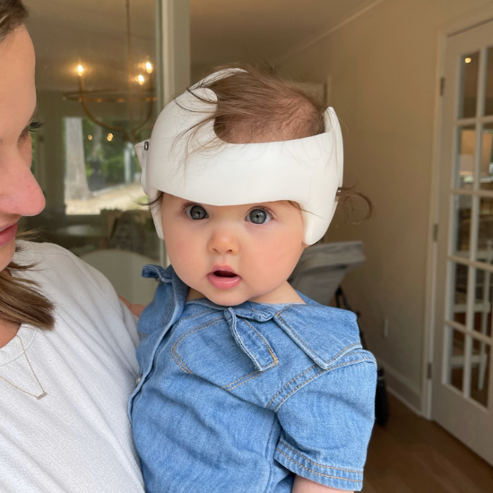 baby wearing cranial helmet